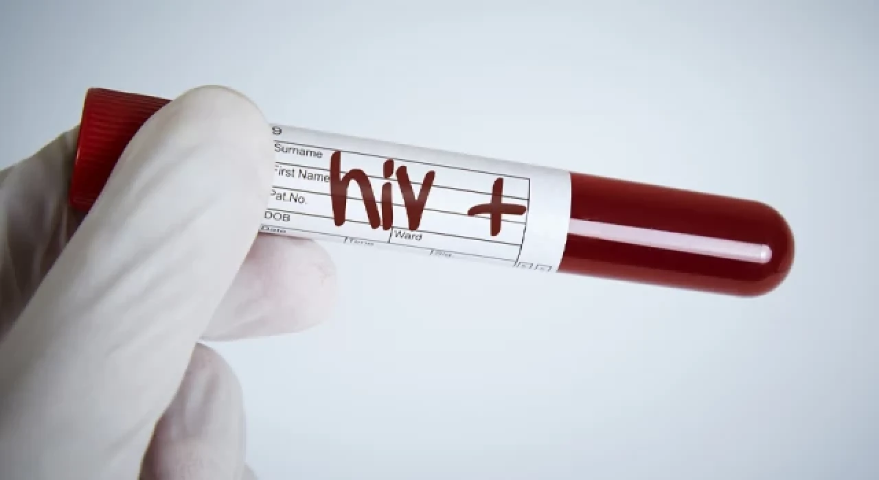 HIV görülme yaşı 15’e kadar indi