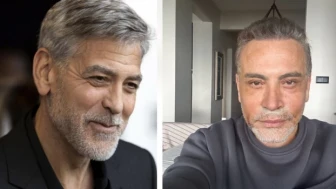 Yüz germe ameliyatı olan şarkıcı Cenk Eren: Ben Türkiye’nin George Clooney’siyim