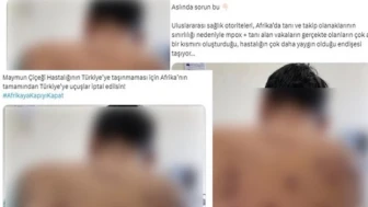 Cumhurbaşkanlığından 'maymun çiçeği' açıklaması