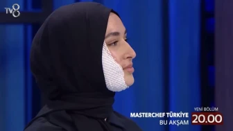 Yüzüne kızgın yağ dökülen Beyza, Masterchef Türkiye'ye geri dönecek mi?