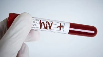 Bilim insanları AIDS'i yüzde 100 oranında durduran ilaç geliştirdi