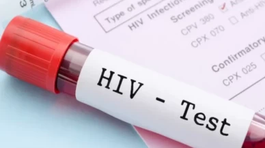 HIV tedavisinde güzel gelişmeler