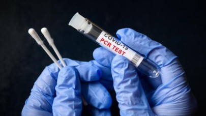 Hızlı PCR Testi: Covid-19 için EKSPRES test