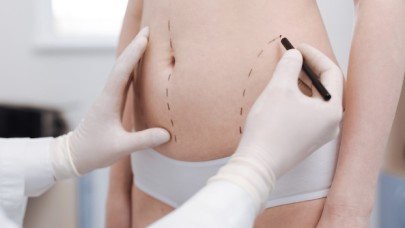 Pandemide kilo alanlar, çareyi liposuction’da buldu