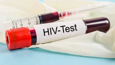 'HIV enfeksiyonunun son 10 yılda yüzde 460 arttığı tek ülke Türkiye'