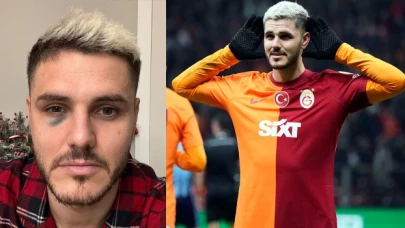 Galatasaray'dan Icardi'nin durumuna ilişkin açıklama geldi