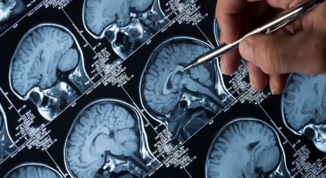 Beyindeki glimfatik sistem: Alzheimer’la mücadelede yeni bir umut