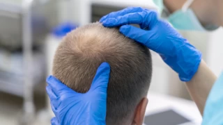 Saç ekimi, botoks ve estetik ameliyatlarına talep azaldı